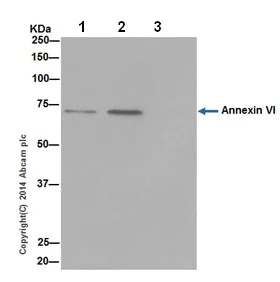 Immunoprecipitation - Anti-Annexin-6/ANXA6 antibody [EPR17308] - BSA and Azide free (AB251272)