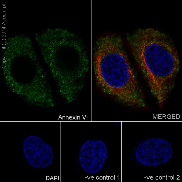Immunocytochemistry/ Immunofluorescence - Anti-Annexin-6/ANXA6 antibody [EPR17308] - N-terminal (ab199422), expandable thumbnail