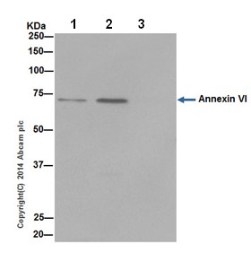 Immunoprecipitation - Anti-Annexin-6/ANXA6 antibody [EPR17308] - N-terminal (AB199422), expandable thumbnail