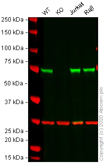 Western blot - Anti-Annexin-6/ANXA6 antibody [EPR17308] - N-terminal (AB199422)