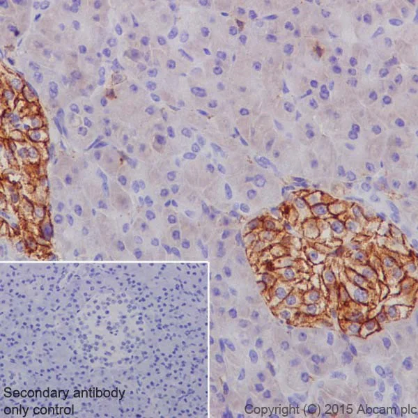 Immunohistochemistry (Formalin/PFA-fixed paraffin-embedded sections) - Anti-Annexin-6/ANXA6 antibody [EPR19517] (AB201023)