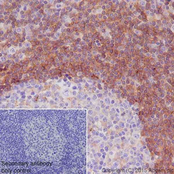 Immunohistochemistry (Formalin/PFA-fixed paraffin-embedded sections) - Anti-Annexin-6/ANXA6 antibody [EPR19517] (AB201023)