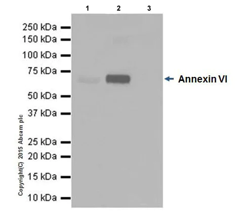 Immunoprecipitation - Anti-Annexin-6/ANXA6 antibody [EPR19517] - BSA and Azide free (AB240359)