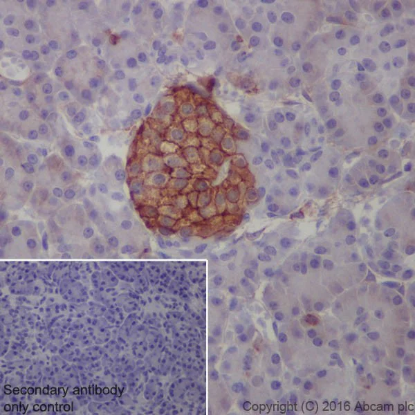 Immunohistochemistry (Formalin/PFA-fixed paraffin-embedded sections) - Anti-Annexin-6/ANXA6 antibody [EPR19536] (AB201024)