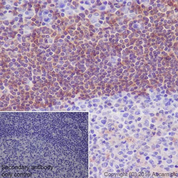Immunohistochemistry (Formalin/PFA-fixed paraffin-embedded sections) - Anti-Annexin-6/ANXA6 antibody [EPR19536] (AB201024)