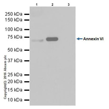 Immunoprecipitation - Anti-Annexin-6/ANXA6 antibody [EPR19536] (AB201024)