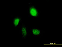 Immunocytochemistry/ Immunofluorescence - Anti-Annexin-7/ANXA7 antibody (AB88539), expandable thumbnail