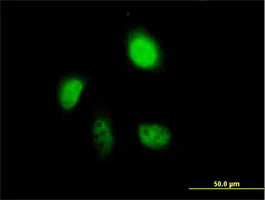 Immunocytochemistry/ Immunofluorescence - Anti-Annexin-7/ANXA7 antibody (AB88539)