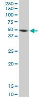 Western blot - Anti-Annexin-7/ANXA7 antibody (AB88539), expandable thumbnail