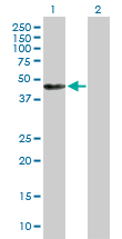 Western blot - Anti-Annexin-7/ANXA7 antibody (AB88539), expandable thumbnail