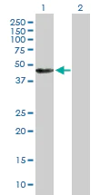Western blot - Anti-Annexin-7/ANXA7 antibody (AB88539)