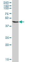 Western blot - Anti-Annexin-7/ANXA7 antibody (AB88539)