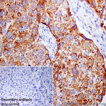 Immunohistochemistry (Formalin/PFA-fixed paraffin-embedded sections) - Anti-Annexin-7/ANXA7 antibody [EPR16173] - N-terminal (ab198990), expandable thumbnail