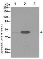 Immunoprecipitation - Anti-Annexin-7/ANXA7 antibody [EPR16173] - N-terminal (AB198990), expandable thumbnail