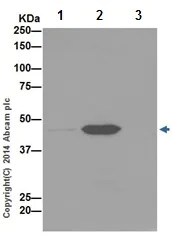 Immunoprecipitation - Anti-Annexin-7/ANXA7 antibody [EPR16173] - N-terminal (AB198990)