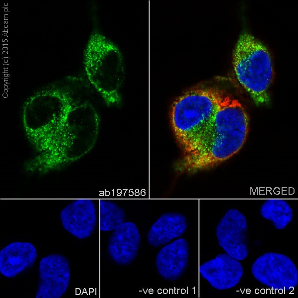 Immunocytochemistry/ Immunofluorescence - Anti-Annexin-7/ANXA7 antibody [EPR17090] (AB197586)