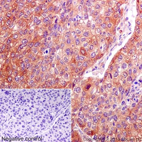 Immunohistochemistry (Formalin/PFA-fixed paraffin-embedded sections) - Anti-Annexin-7/ANXA7 antibody [EPR17090] - BSA and Azide free (AB251240)