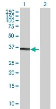 Western blot - Annexin-8/ANXA8 overexpression 293T lysate (whole cell) (AB94176)