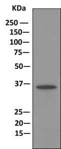 Immunoprecipitation - Anti-Annexin-9/ANXA9 antibody [EPR11220] (AB166621), expandable thumbnail