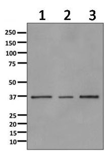 Western blot - Anti-Annexin-9/ANXA9 antibody [EPR11220] (AB166621), expandable thumbnail