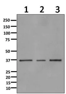 Western blot - Anti-Annexin-9/ANXA9 antibody [EPR11220] (AB166621)