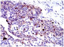 Immunohistochemistry (Formalin/PFA-fixed paraffin-embedded sections) - Anti-Annexin A1/ANXA1 antibody [2F1] (AB135256)
