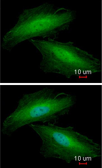 Immunocytochemistry/ Immunofluorescence - Anti-Annexin A1/ANXA1 antibody (AB137745), expandable thumbnail