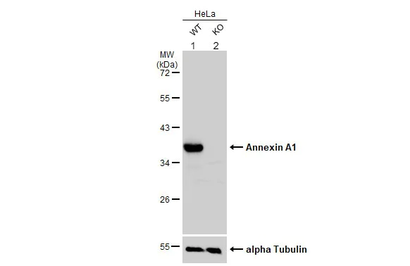 Western blot - Anti-Annexin A1/ANXA1 antibody (AB137745)