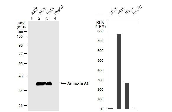 Western blot - Anti-Annexin A1/ANXA1 antibody (AB137745)