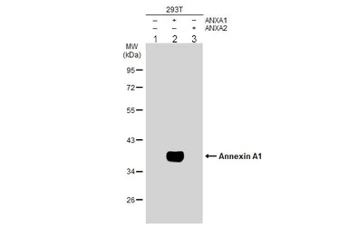 Western blot - Anti-Annexin A1/ANXA1 antibody (AB137745)