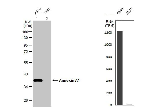 Western blot - Anti-Annexin A1/ANXA1 antibody (AB137745)