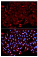 Immunocytochemistry/ Immunofluorescence - Anti-Annexin A1/ANXA1 antibody (AB196830), expandable thumbnail