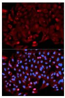 Immunocytochemistry/ Immunofluorescence - Anti-Annexin A1/ANXA1 antibody (AB196830)