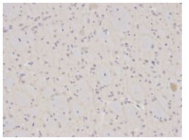 Immunohistochemistry (Formalin/PFA-fixed paraffin-embedded sections) - Anti-Annexin A1/ANXA1 antibody (AB196830), expandable thumbnail