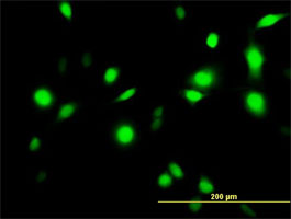 Immunocytochemistry/ Immunofluorescence - Anti-Annexin A1/ANXA1 antibody (AB88865), expandable thumbnail