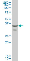 Western blot - Anti-Annexin A1/ANXA1 antibody (AB88865), expandable thumbnail