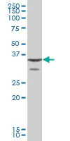 Western blot - Anti-Annexin A1/ANXA1 antibody (AB88865)
