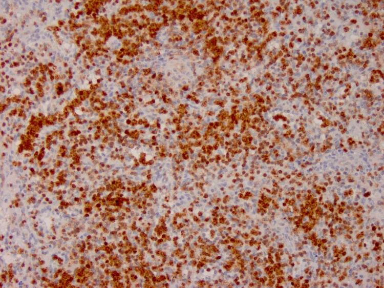 Immunohistochemistry (Formalin/PFA-fixed paraffin-embedded sections) - Anti-Annexin A1/ANXA1 antibody [ANXA1/3566] - BSA and Azide free (AB268191)
