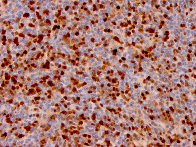 Immunohistochemistry (Formalin/PFA-fixed paraffin-embedded sections) - Anti-Annexin A1/ANXA1 antibody [ANXA1/3566] - BSA and Azide free (ab268191), expandable thumbnail