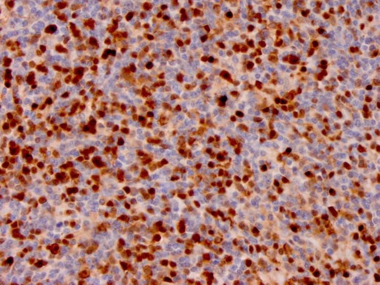 Immunohistochemistry (Formalin/PFA-fixed paraffin-embedded sections) - Anti-Annexin A1/ANXA1 antibody [ANXA1/3566] - BSA and Azide free (AB268191)