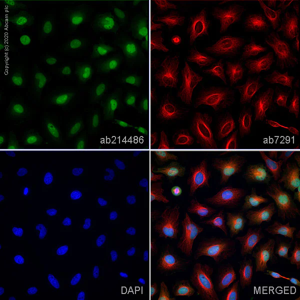 Immunocytochemistry/ Immunofluorescence - Anti-Annexin A1/ANXA1 antibody [EPR19342] (AB214486)