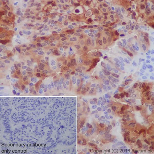 Immunohistochemistry (Formalin/PFA-fixed paraffin-embedded sections) - Anti-Annexin A1/ANXA1 antibody [EPR19342] (AB214486)