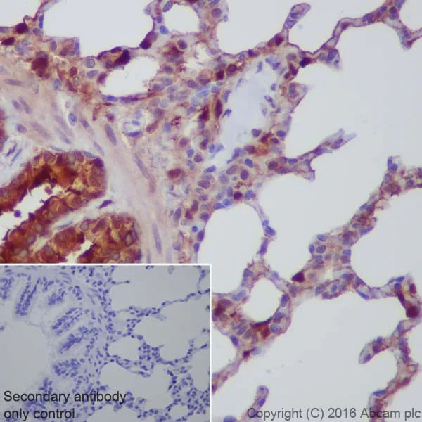 Immunohistochemistry (Formalin/PFA-fixed paraffin-embedded sections) - Anti-Annexin A1/ANXA1 antibody [EPR19342] (AB214486)
