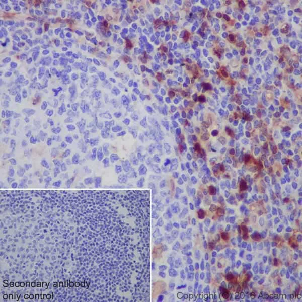 Immunohistochemistry (Formalin/PFA-fixed paraffin-embedded sections) - Anti-Annexin A1/ANXA1 antibody [EPR19342] (AB214486)