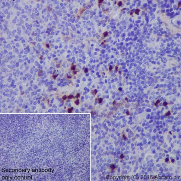 Immunohistochemistry (Formalin/PFA-fixed paraffin-embedded sections) - Anti-Annexin A1/ANXA1 antibody [EPR19342] - BSA and Azide free (AB222398)