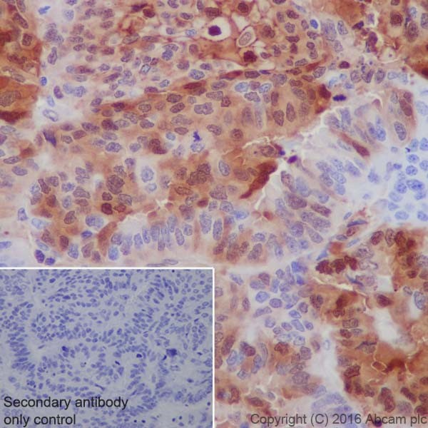 Immunohistochemistry (Formalin/PFA-fixed paraffin-embedded sections) - Anti-Annexin A1/ANXA1 antibody [EPR19342] - BSA and Azide free (ab222398), expandable thumbnail