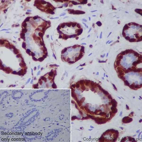 Immunohistochemistry (Formalin/PFA-fixed paraffin-embedded sections) - Anti-Annexin A1/ANXA1 antibody [EPR19342] - BSA and Azide free (ab222398), expandable thumbnail