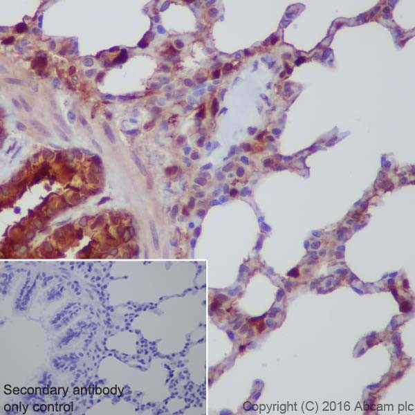 Immunohistochemistry (Formalin/PFA-fixed paraffin-embedded sections) - Anti-Annexin A1/ANXA1 antibody [EPR19342] - BSA and Azide free (ab222398), expandable thumbnail