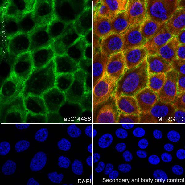 Immunohistochemistry (Formalin/PFA-fixed paraffin-embedded sections) - Anti-Annexin A1/ANXA1 antibody [EPR19342] - BSA and Azide free (AB222398), expandable thumbnail