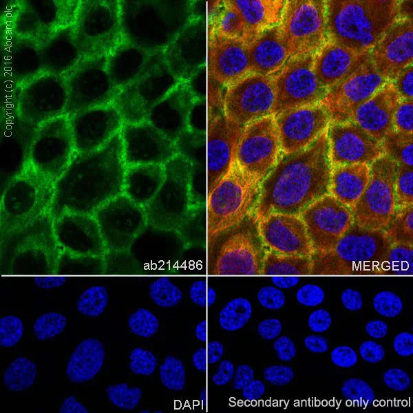 Immunohistochemistry (Formalin/PFA-fixed paraffin-embedded sections) - Anti-Annexin A1/ANXA1 antibody [EPR19342] - BSA and Azide free (AB222398)